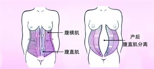 产后修复中心小型变大型，母乳分析仪器是专业性的体现