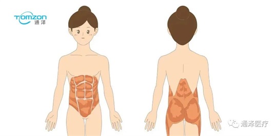 产后塑形仪器？产后腹直肌仪器？教你如何在产后有效塑形
