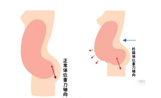 盆底恢复是否可以使用仪器？