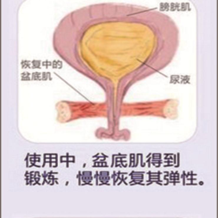 盆底肌康复治疗